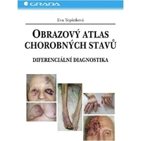 Obrazový atlas chorobných stavů - E-kniha