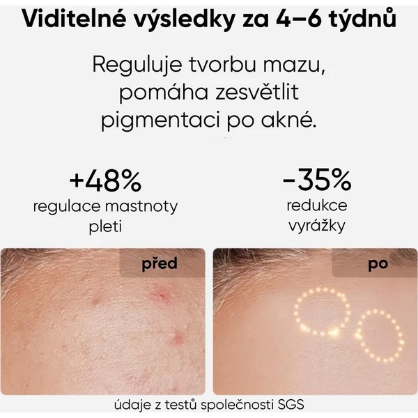 JOVS LED světelná terapeutická maska na obličej - Čističe pleti - Obrázek f70c6bd50ea147be817bb87d51f22fa2