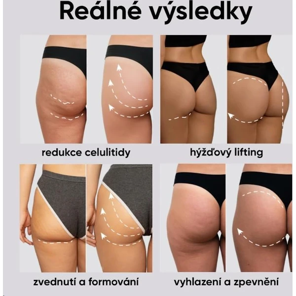 JOVS EMS tonizující šortky (F) - Čističe pleti - Obrázek fa17ab25413a4b5bac7d5c00dedd9f53